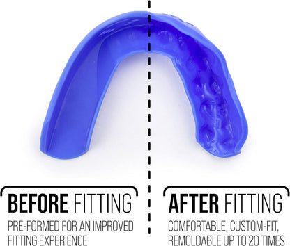 SISU 3D Mouthguard