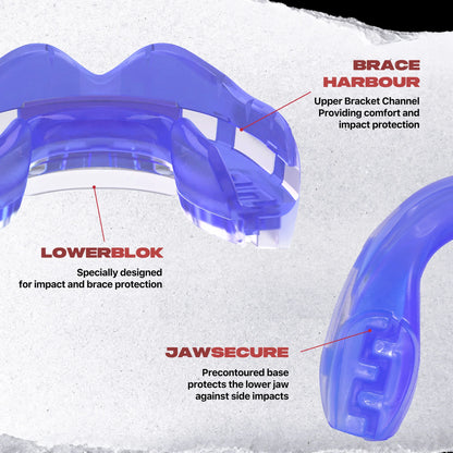 SafeJawz Ortho Series Mouthguard – Ice Blue (for Braces)